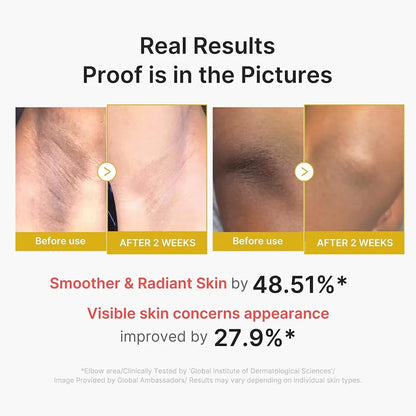 Medicube Kojic Acid Turmeric Body Peel Shot