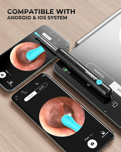 Smart Ear Wax Removal with HD Camera