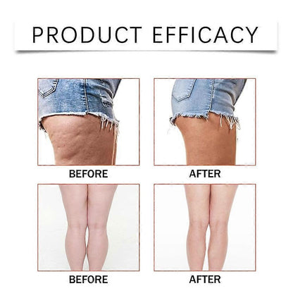 Thigh/Legs Lift Patches Tape